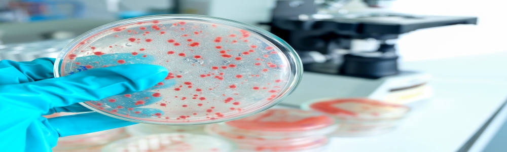Microbiological Food Testing